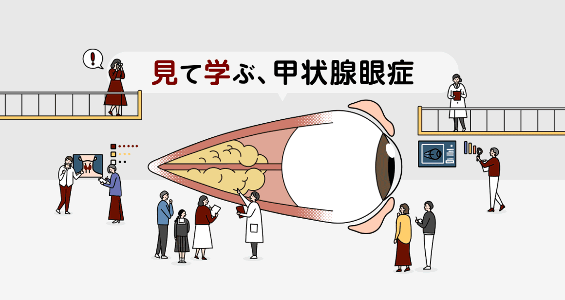 見て学ぶ、甲状腺眼症