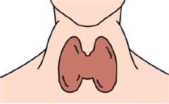 Graves disease