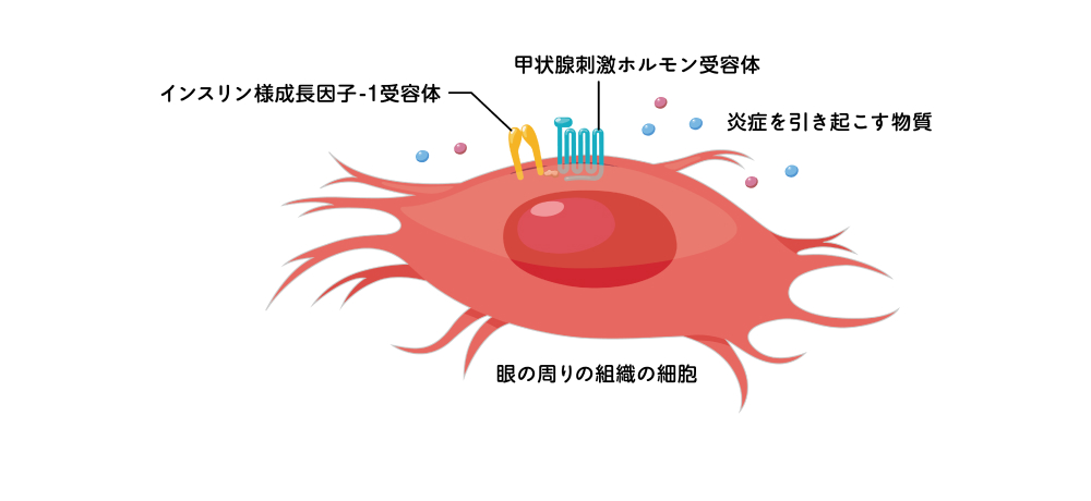 図：眼の周りの組織で炎症が起こるしくみ